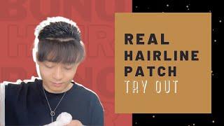 UNDETECTABLE Hairline Patch | Before & After | Bono Hair | Hair System #Shorts