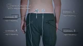 Lumbar Placement with Radiating Pain Example