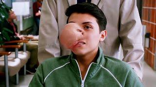 The boy developed a large tumor on his face
