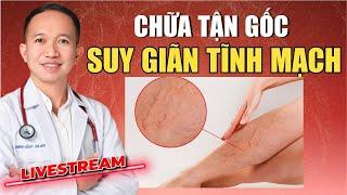 CHỮA TẬN GỐC SUY GIÃN TĨNH MẠCH CHÂN CÙNG VỚI BÁC SĨ TĨNH MẠCH