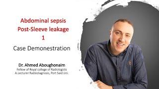 | GIT | abdominal sepsis | post-sleeve leakage | 1 |