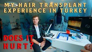 My Turkish Hair Transplant Journey: From Fear to Confidence in 3 Days