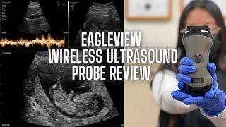 EagleView Wireless Portable Doppler Ultrasound Review | Full-body diagnostic imaging + discount code