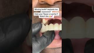 Got missing teeth? Hate your partial? Can't afford implants? Watch this !