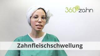 Zahnfleischschwellung - Was ist eine Zahnfleischschwellung? | Dental-Lexikon | 360°zahn