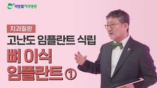 튼튼한 잇몸뼈가 임플란트 수명을 좌우 합니다