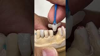 Ceramic for Lower teeth