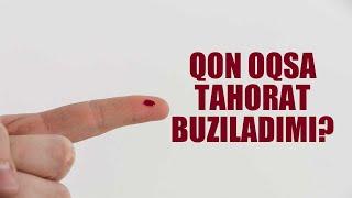 Qon oqsa tahorat buziladimi? | Shayx Sodiq Samarqandiy