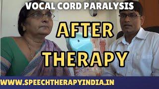 SLP Sanjay Kumar: After Vocal Cord Paralysis  Therapy || Without Surgery || India