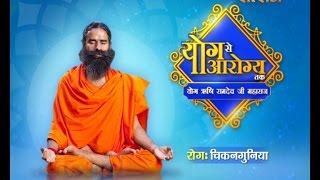 How To Cure Chikungunya (चिकनगुनिया) With Yoga & Ayurveda || Swami Ramdev || Yog Se Arogya Tak