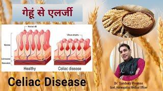 Celiac Disease Homeopathic Treatment | गेहूं से एलर्जी | Wheat Allergy by Dr Sandeep Premee