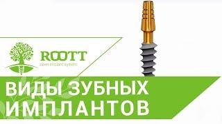 Зубной имплантат установка.  Особенности установки компрессионных зубных имплантатов.