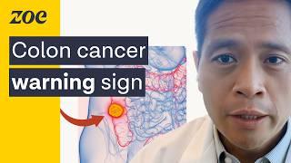 Harvard Doctor: Why young people are getting colon cancer | Dr. Andy Chan