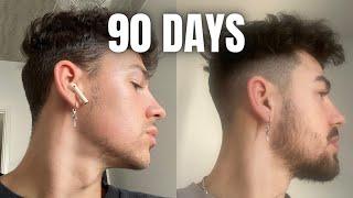 How To GROW A BEARD In 90 Days Using MINOXIDIL & DERMA ROLLER