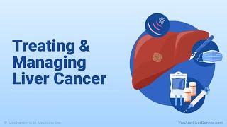 Treating and Managing Liver Cancer