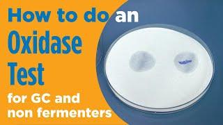 How to perform an Oxidase test in microbiology for gonorrhea and non fermenters