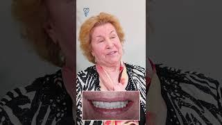Зубы из циркония выглядят как свои зубы. Имплантация зубов.