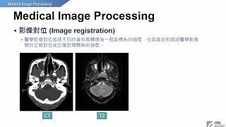 以案例剖析AI智慧醫療影像辨識技術試讀影片 影像對位