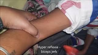 Biceps Jerk Reflex - Normal vs Hyper Reflexia ( UMN lesion)