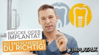 Brücke oder Implantat? So entscheidest du richtig! Implatalk EP 16