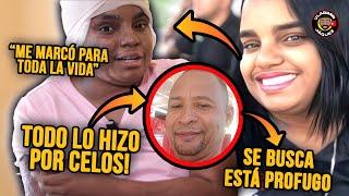 POR CELOS! SU MARIDO LA MARCÓ PARA TODA LA VIDA | LA TRISTE HISTORIA DE ROBELKIS