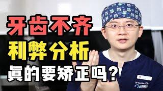 牙不齐，我闭嘴不影响颜值吧？北大正畸博士苦劝：牙齿不齐还有很多弊端...