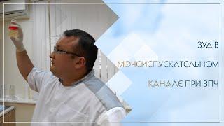 ▶ Зуд в мочеиспускательном канале при ВПЧ. Клинический случай №83