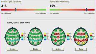 Tennessee Neurofeedback and brain mapping