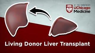 Living Donor Liver Transplant