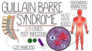 Guillain Barre Syndrome Explained Clearly (Including Subtypes)