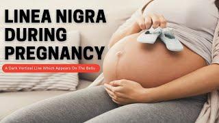 Linea Nigra During Pregnancy | Private Ultrasound Baby Scan clinic Reading