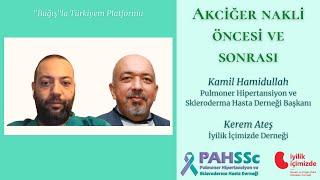 İyilik İçimizde Derneği - PAHSSc - Akciğer nakli öncesi ve sonrası