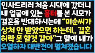 (신청사연) 인사드리러 처음 시댁에 갔더니 내 얼굴에 있는 흉터를 본 시모가 결혼을 반대 하시는데 " 미순씨가 상처 안 받았으면~[사이다사연][감동사연][라디오 드라마][오디오북]