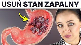 Lista * CO JEŚĆ * by usunąć stan zapalny żołądka i dwunastnicy