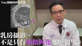 【Tony醫師的科男世界8】乳房攝影，不是只有顯微鈣化那麼簡單!