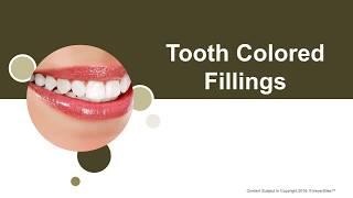 Tooth-Colored Fillings  - White Spruce Dental - Family Dentists, Cosmetic Dentists, Invisalign