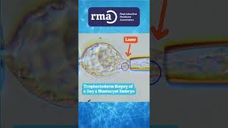 Trophectoderm Biopsy of a Day 5 Blastocyst Embryo #Shorts