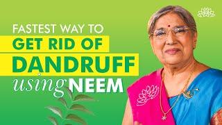 Home Treatments for Dandruff Using NEEM | DIY | Hair Care Tips | Dr. Hansaji Yogendra