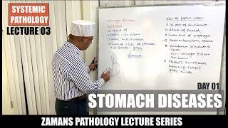 Systemic Pathology: Lecture 03| Stomach Diseases : Day 01