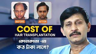 Hair Transplant in Kolkata | Best Results & Cost of Hair Transplant in Kolkata | Dr. Manoj Khanna