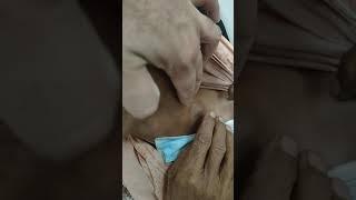 cervical lymph nodes