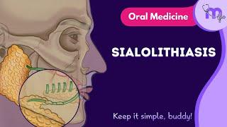 Sialolithiasis | Full Video | Oral Medicine | Medi Study Go