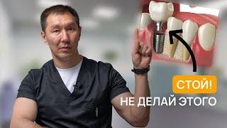 Вам НЕЛЬЗЯ ставить ИМПЛАНТЫ. 5 Главных ФАКТОВ, которые ты должен знать