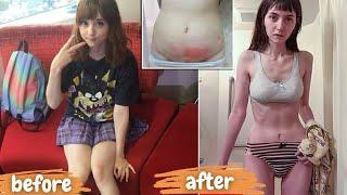 The YouTuber who almost died from weight-loss surgery despite being only 53kg | Venus Angelic Part 3