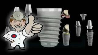 What is a Dental Implant?