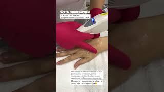 Фотоомоложение кистей рук. Избавляемся от пигментных пятен в Центре косметологии Elitelle