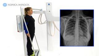 Advanced U-arm System, Dynamic Digital Radiography (DDR) | Konica Minolta Healthcare