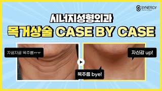 목거상술 CASE BY CASE 【가로+세로 깊은 목주름】 거상 수술 후, 어떻게 변화됐을까? 영상을 통해 직접! 확인해 보세요