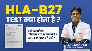 HLA-B27 test क्या होता है? Back Pain Test ( Positive आये तो क्या करें ) Dr. Jitesh Jain