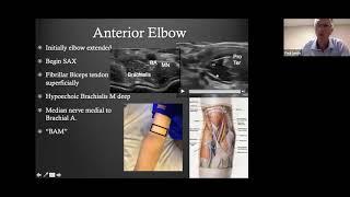 Dr. Paul Lento talks about Diagnostic/Dynamic MSK Ultrasound of Elbow